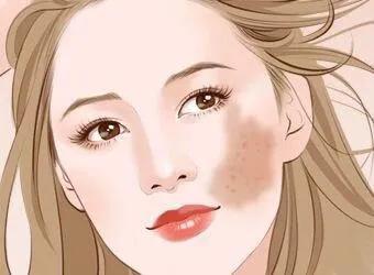 哪些外用药对*褐斑黄**有效?