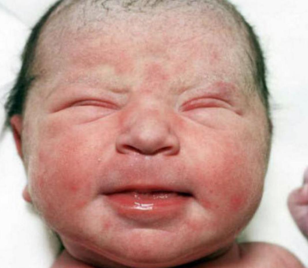 刚出生的婴儿好看为什么越来越丑,新生儿宝宝丑图