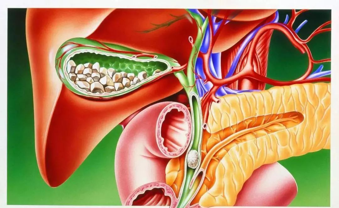 如果你的孩子得了病怎么办,儿童得胆结石怎么处理比较好