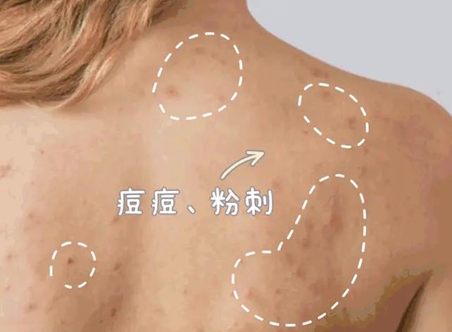 水压小增压花洒过滤,洗澡改用喷淋花洒节水