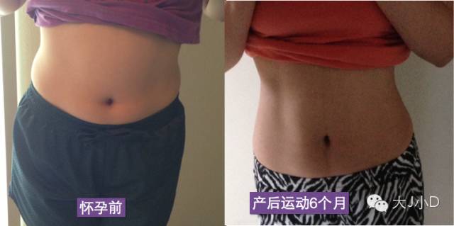 产后恢复有哪些需要注意的？有哪些关键问题不能忽视？