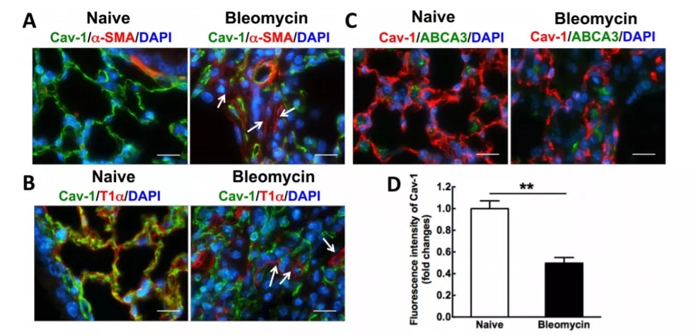 肺纤维化转基因小鼠,fxr基因敲除小鼠