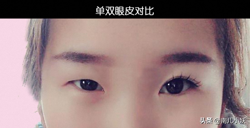 单眼皮一般做什么类型双眼皮,单眼皮不割双眼皮怎么样变好看