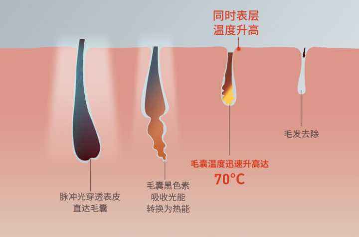 女生脸上长胡子如何调理,女生脸上长小胡子怎么办