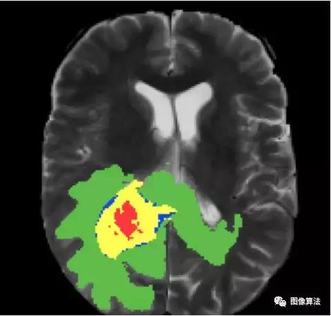 keras语义分割,keras机器学习教程