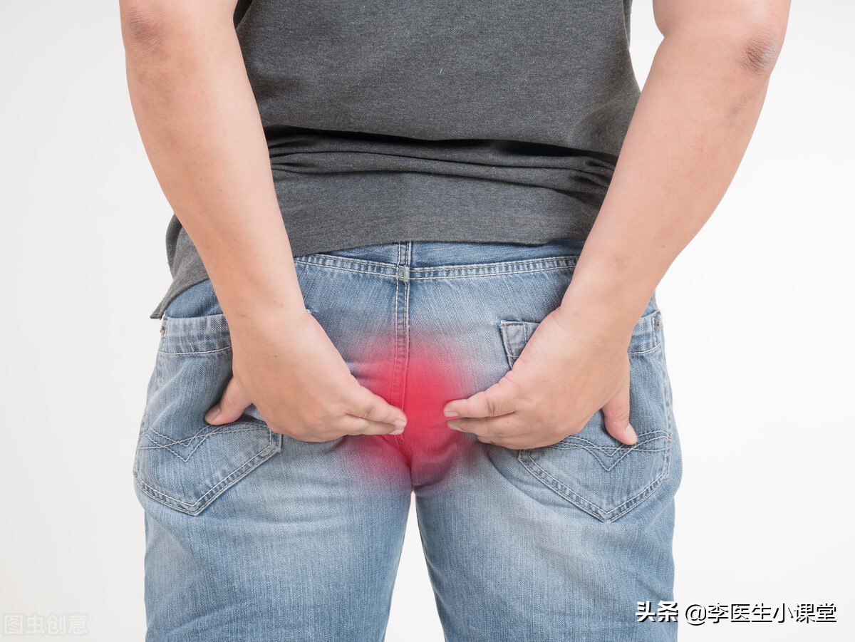 用痔疮药膏可以消除痔疮肉球吗,怎么办才能使痔疮的小肉球消退