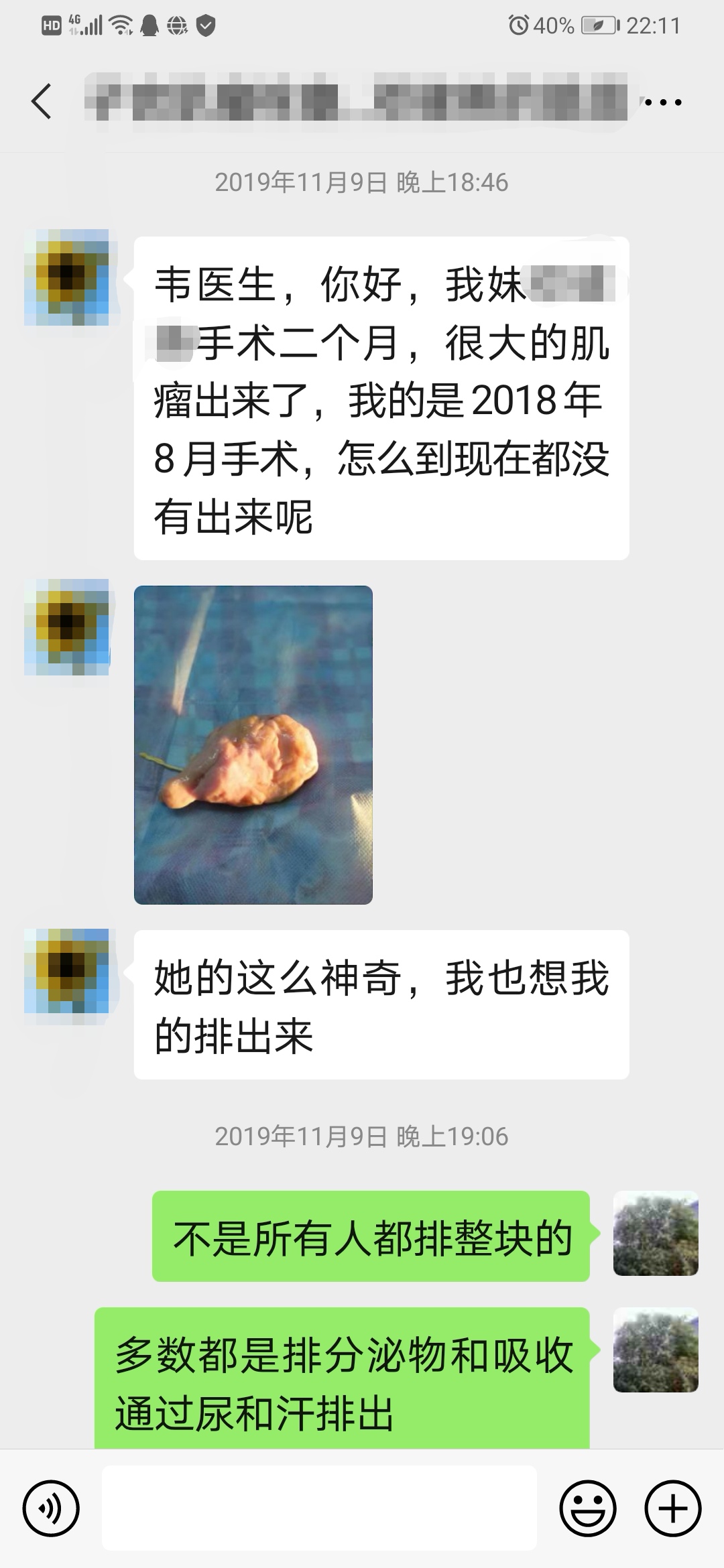 子宫肌瘤微创后月经量大有血块,严重贫血子宫肌瘤手术风险大不大