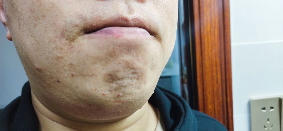 便携剃须新体验,舒适平滑剃须体验