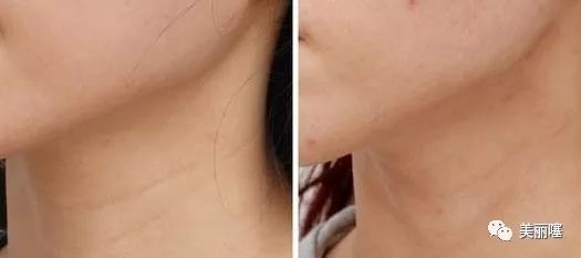 为什么微商的品牌化妆品那么便宜,微商的大牌化妆品为什么那么便宜