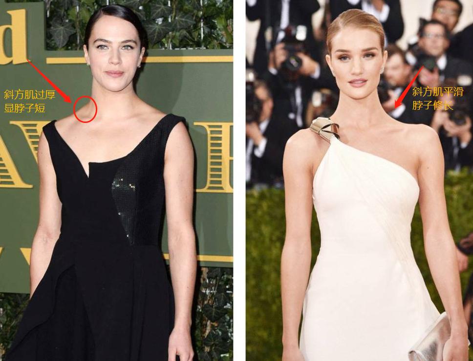 斜方肌越练越大的原因女的,斜方肌厚显得脖子短