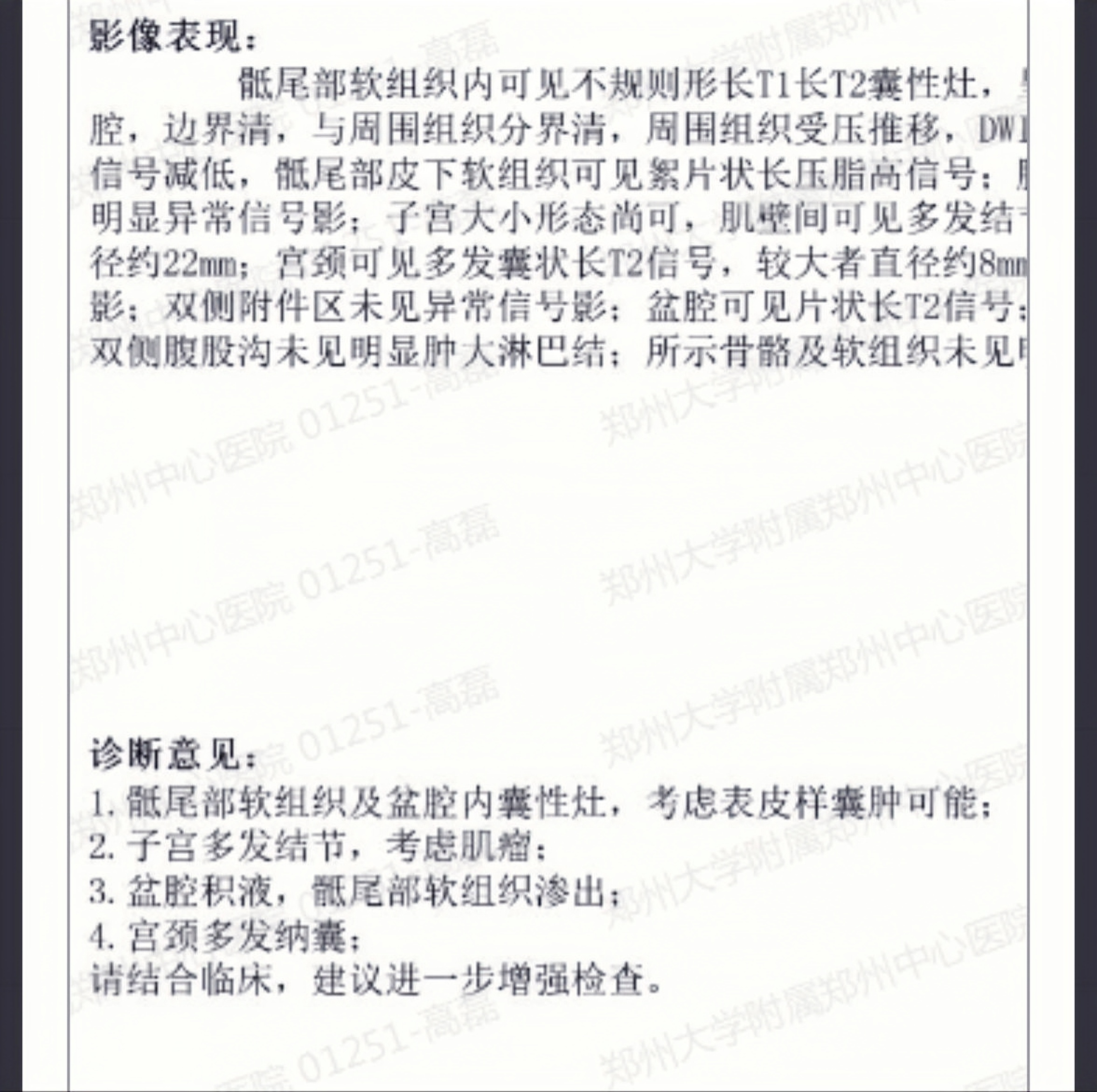 4cm的骶尾部囊肿,骶前发育性囊肿