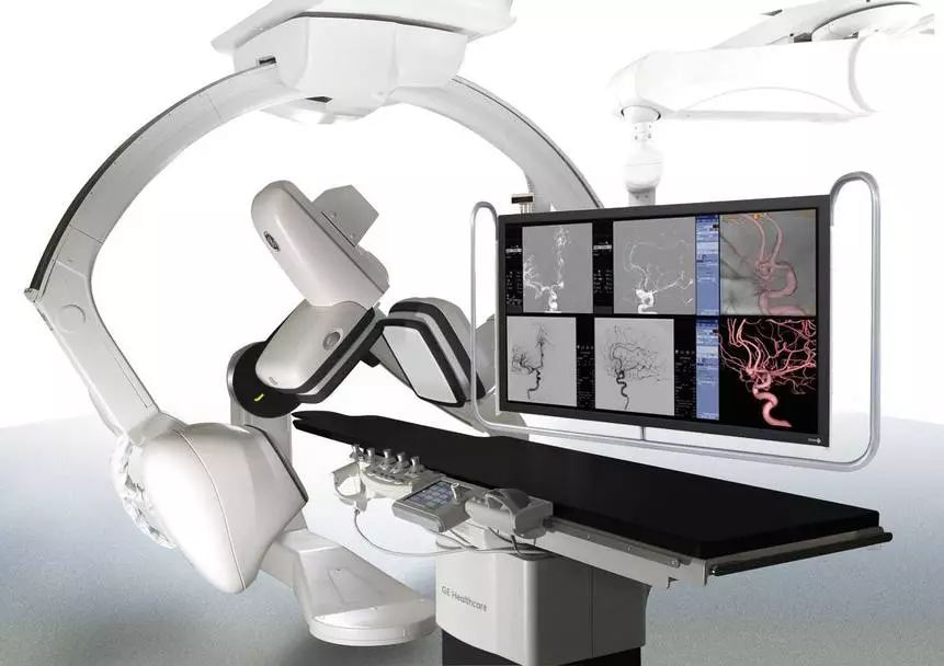 举例科普|介入能治疗哪些疾病?