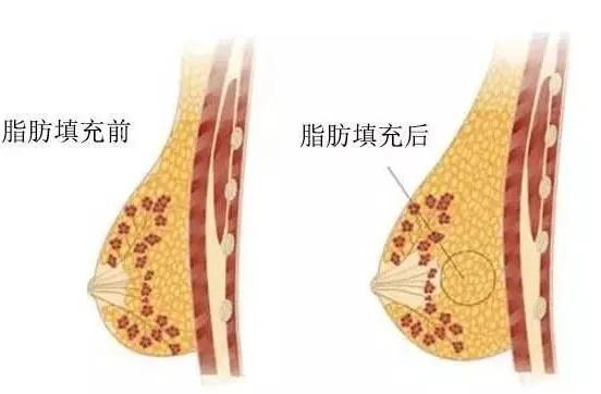 女生运动瘦不下来,女人运动瘦不下来怎么回事