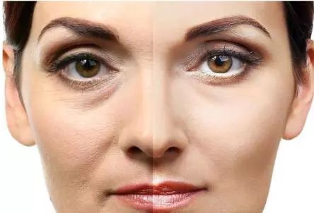 洗澡时搓下来的泥是什么？在显微镜下放大一百倍，看后让人不舒服