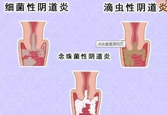 应该做哪些防护措施,做好这3项防护措施