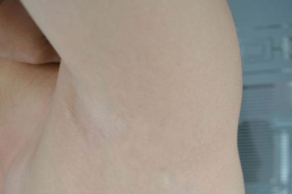 为什么有的女人有腋毛,女人有腋毛好还是没有腋毛好