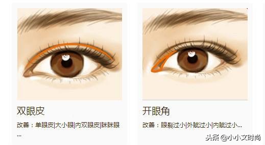 双眼皮后医生不建议用祛疤药,双眼皮手术后医生当场让看效果吗