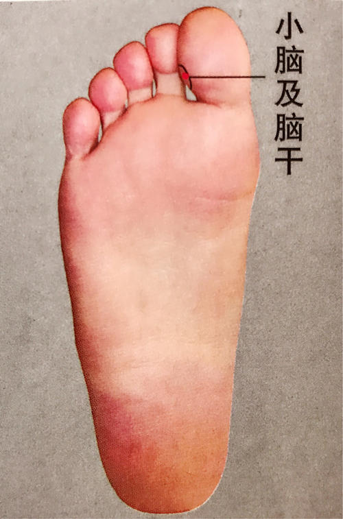 头痛快速止痛方法,偏头痛10秒止疼法躺下就痛