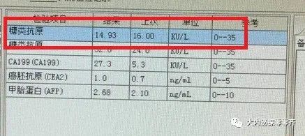 有肿瘤是否肿瘤标志物一定会偏高,肿瘤标志物升高意味着什么
