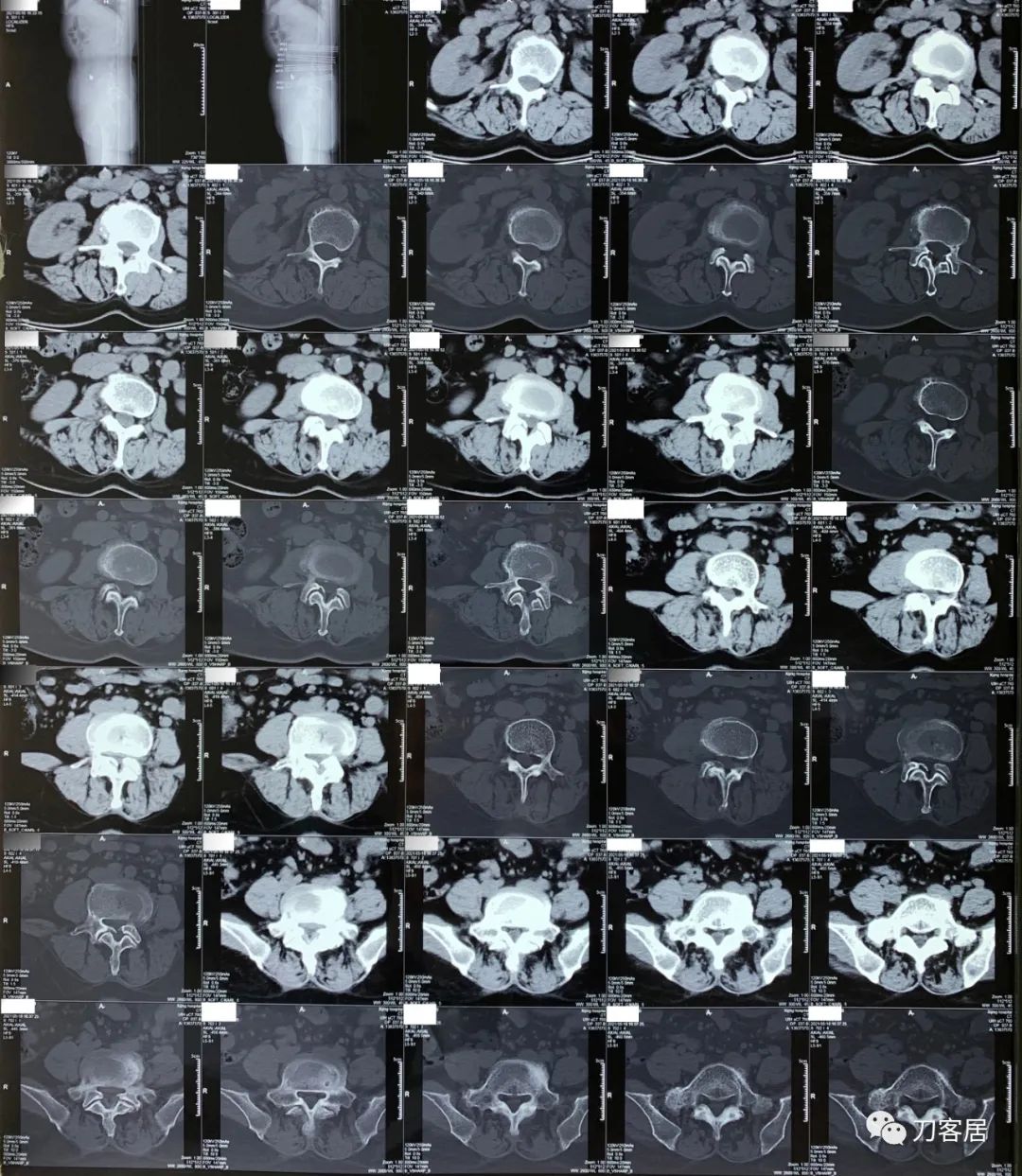 我的门诊病历,我的门诊