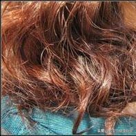 脱发断发方法,脱发掉发的福音