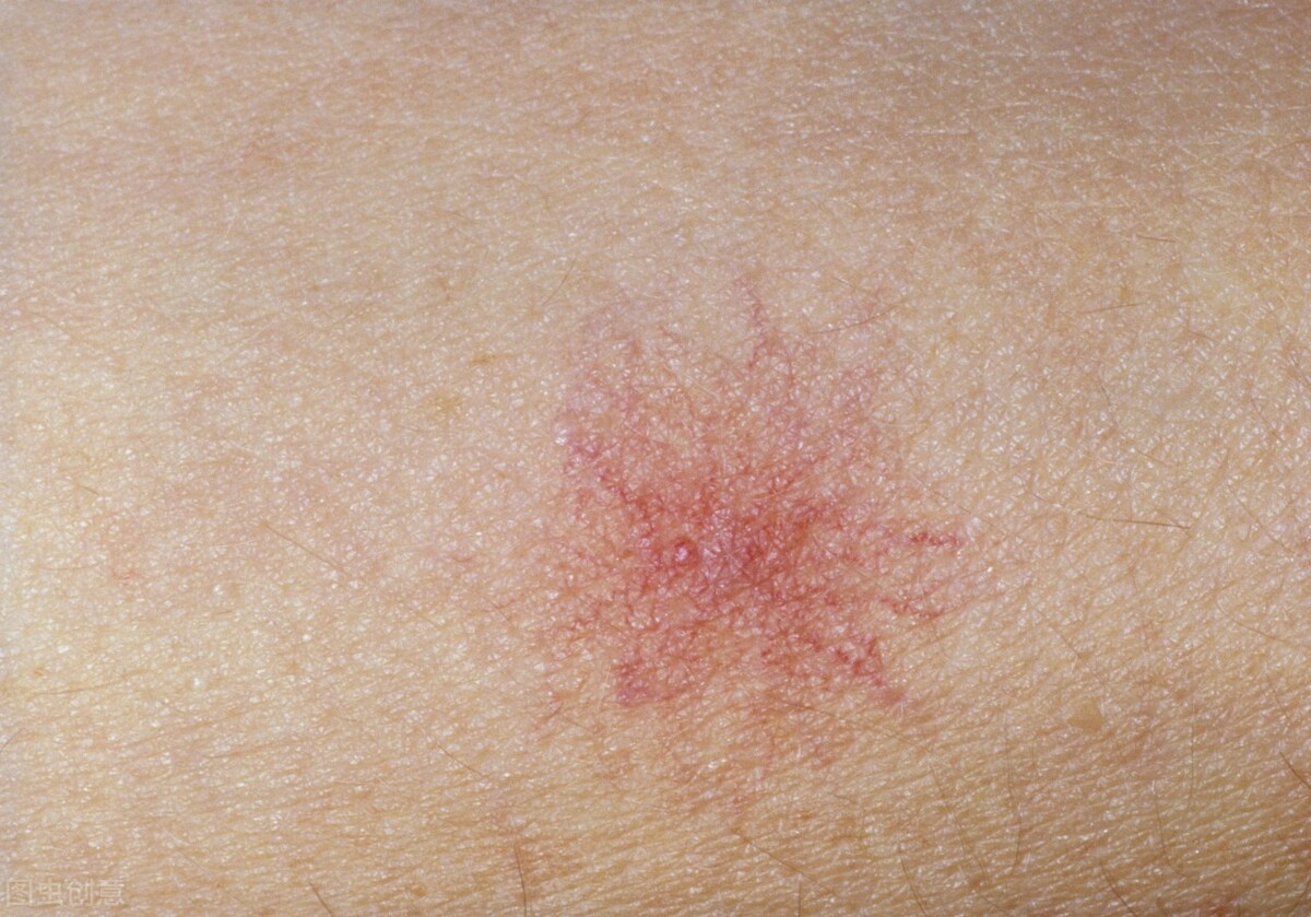 手臂有小红点是什么原因,手臂上出现很多小红点是什么原因