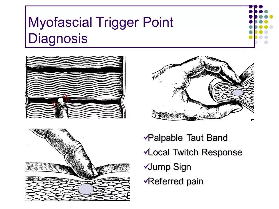 康复训练手法干货分享,康复治疗师肌肉