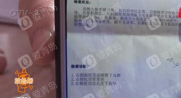 青岛幼儿园男孩头部受伤,青岛幼儿园5岁男孩摔伤后续