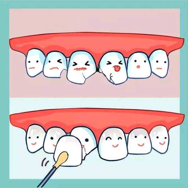 智齿蛀牙痛有什么有效方法止痛,智齿旁边牙松动蛀牙如何处理