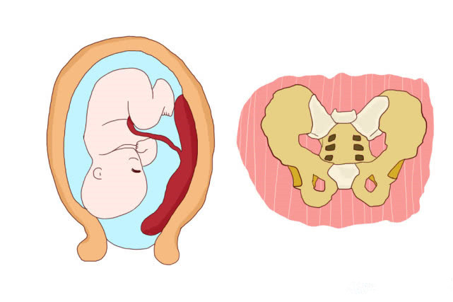 分娩疼怎么安慰,顺产撕裂的原因及缓解方法