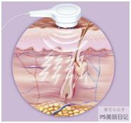 法令纹都是有什么方法可以去除,去法令纹最有效的办法明星