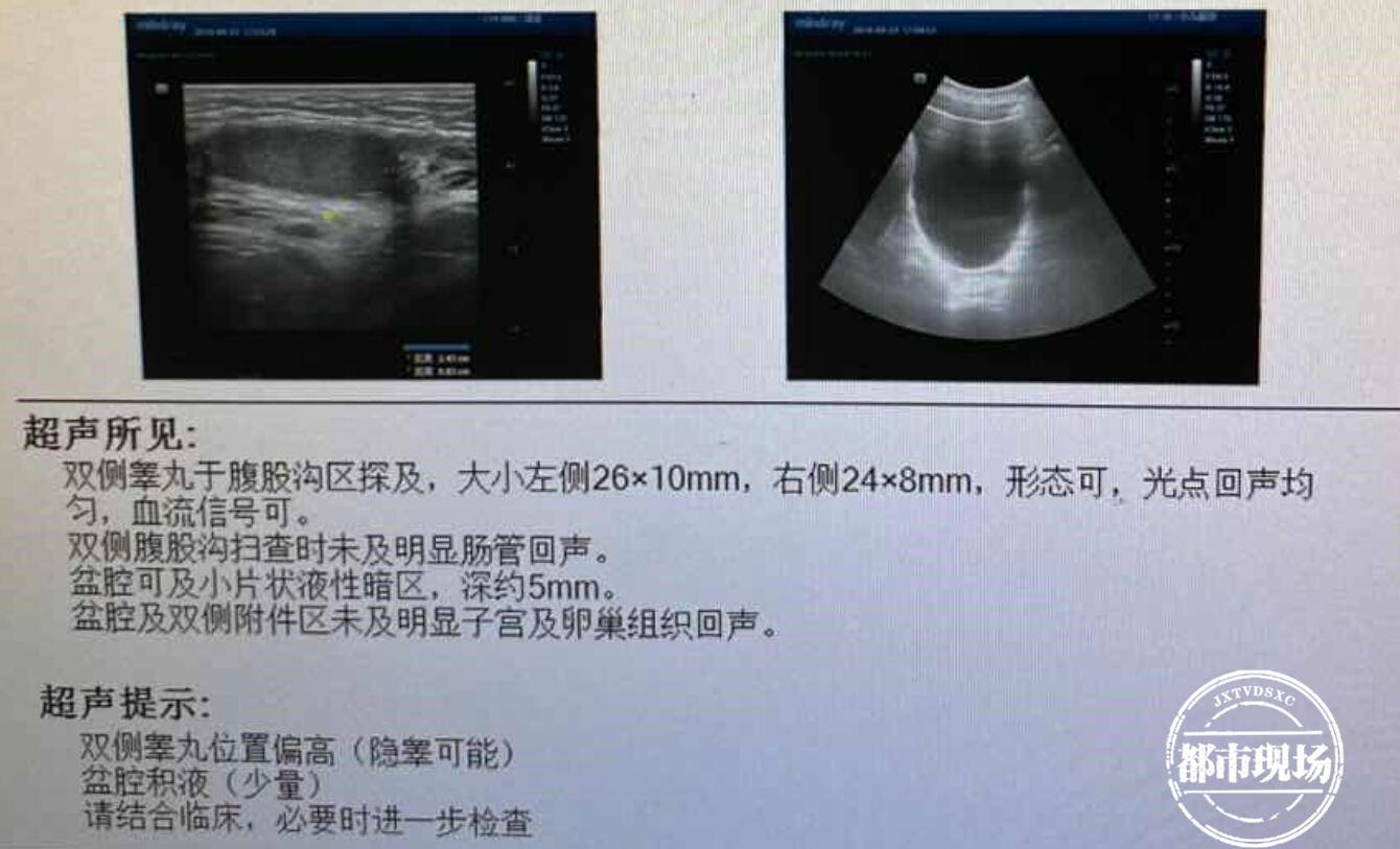 十四岁女孩一直不发育,女生14岁不发育是什么原因