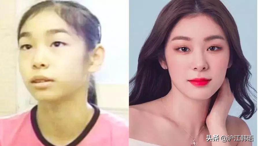 女明星矫正牙齿前后对比,明星牙齿矫正前后对比图