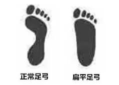家长如何帮助矫正扁平足,孩子扁平足用不用治