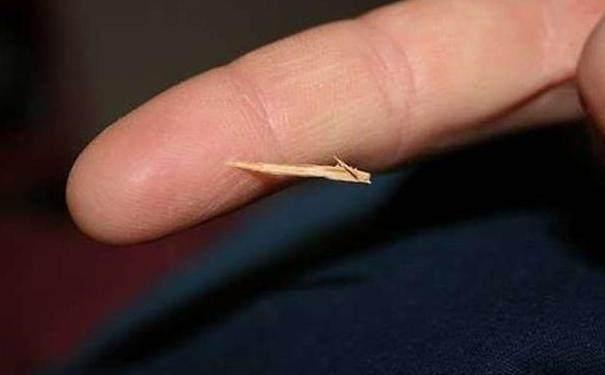 儿童简单外伤的处理方法,如何讲解儿童外伤处理小常识