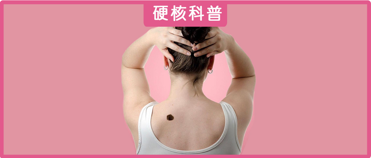 脸上点了痣能洗脸吗应注意什么,这四种痣一定要引起注意了