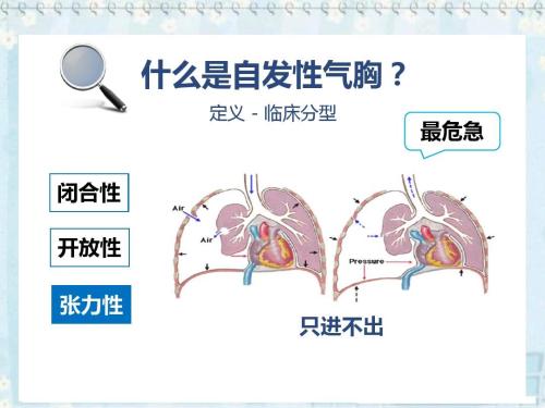 没有诱因的胸痛会是冠心病吗,冠心病胸痛要警惕