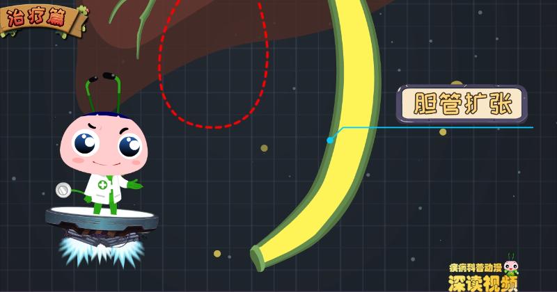 怎么样区分胆囊息肉和胆囊癌,胆囊息肉真假鉴别