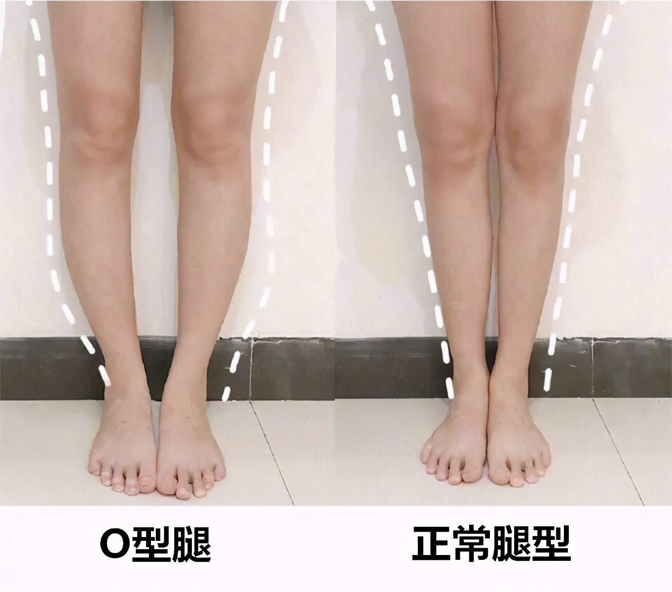 全身关节都有毛病怎么治,膝关节为什么会发炎