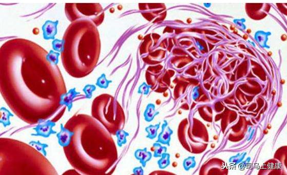 阴虚有火；肺热燥咳、可以用它泡茶喝，效果不错