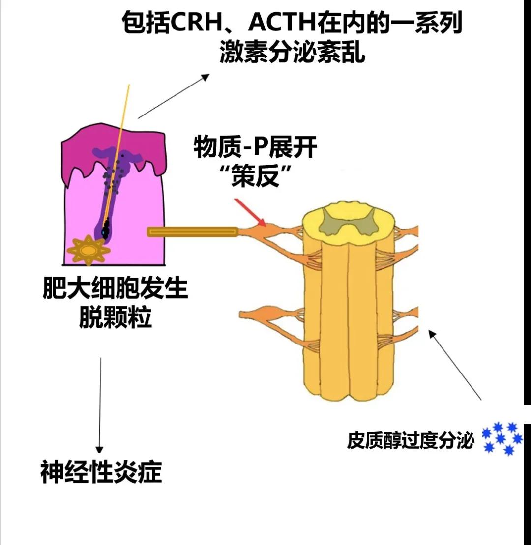 学习压力大导致脱发怎么办,压力导致的脱发还能恢复么