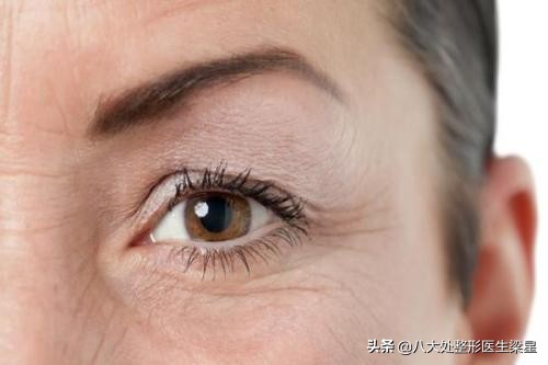 抬头纹真的与上睑下垂有关吗,睁大眼睛就有抬头纹怎么办