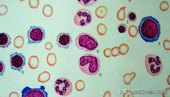 急性髓细胞白血病复发如何治疗？