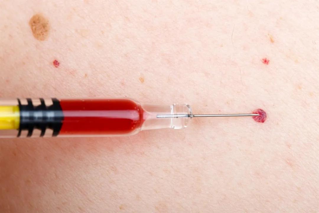 身上出现这种红点千万要注意,身上出现了许多小红点怎么治疗