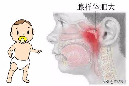 宝宝感冒好后打呼噜什么原因,宝宝感冒好了以后打呼噜正常吗