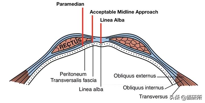 猫咪绝育手术，到底是正切好？还是侧切好？