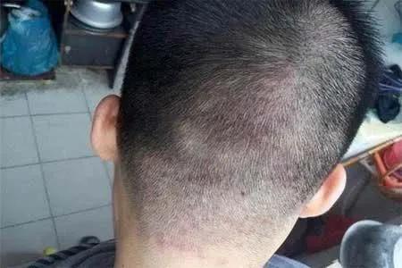 床单不洗螨虫成千上万,床单30天不洗竟螨虫成堆