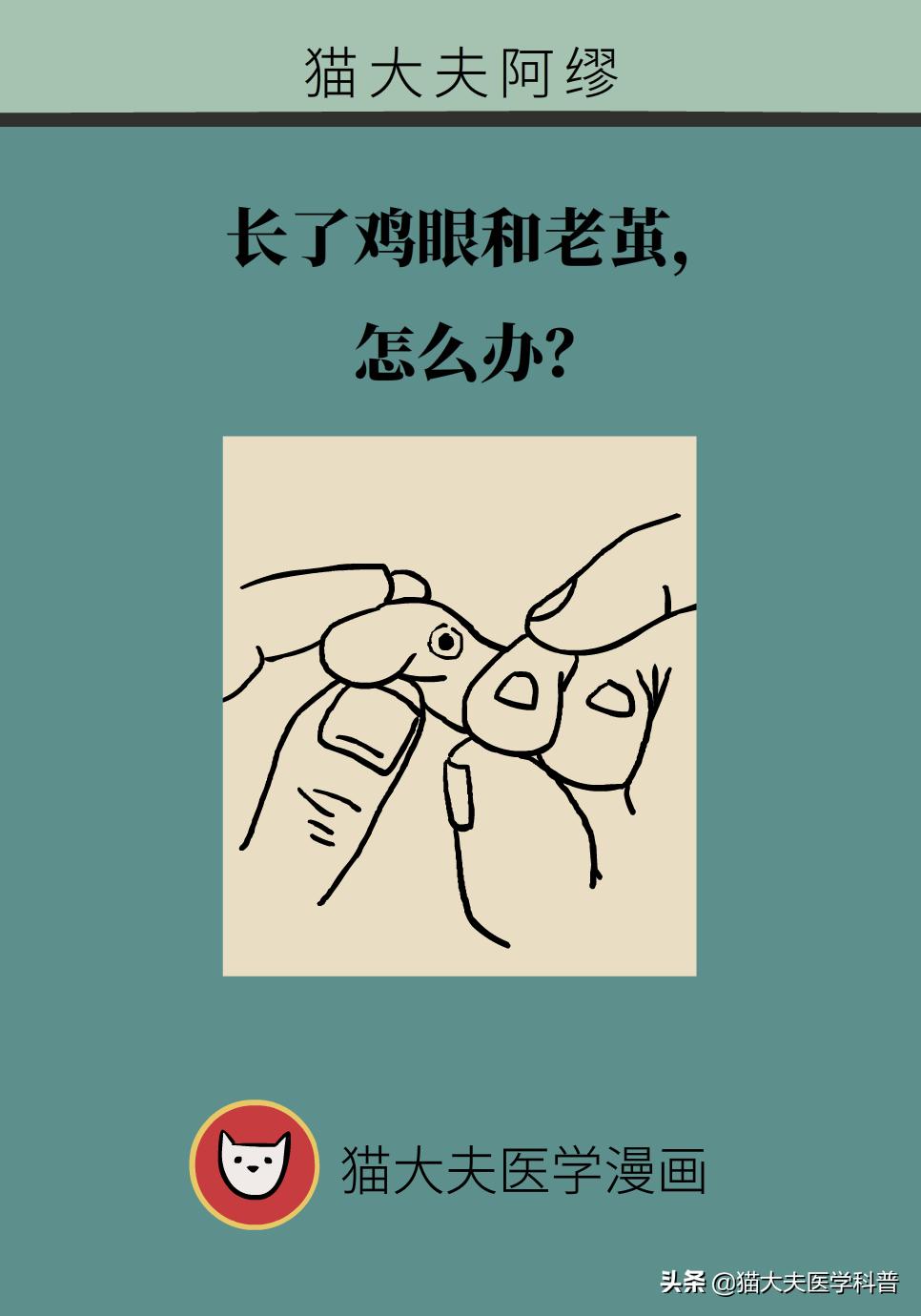 鸡眼好了长了一层老茧,鸡眼与老茧的区别图片