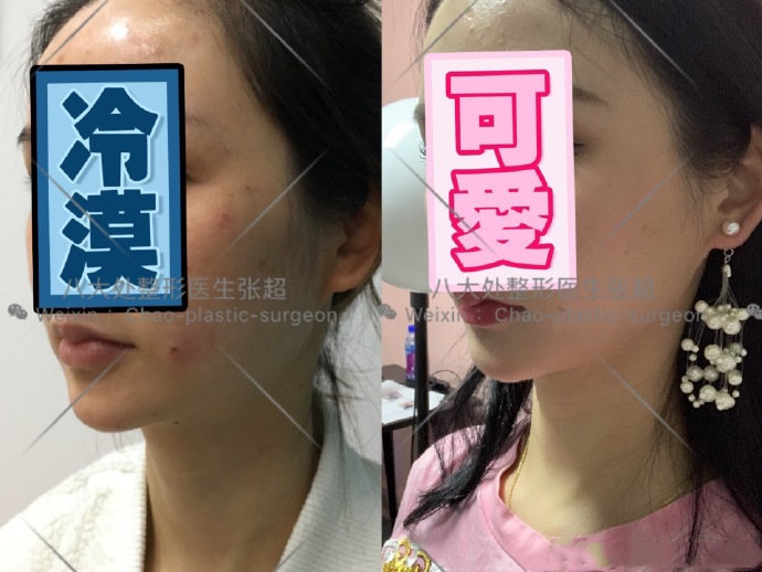 八大处整形张超,八大处张超最新视频