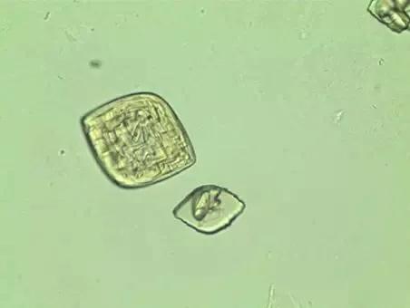 看尿酸化验单,检查尿酸600以上的图片